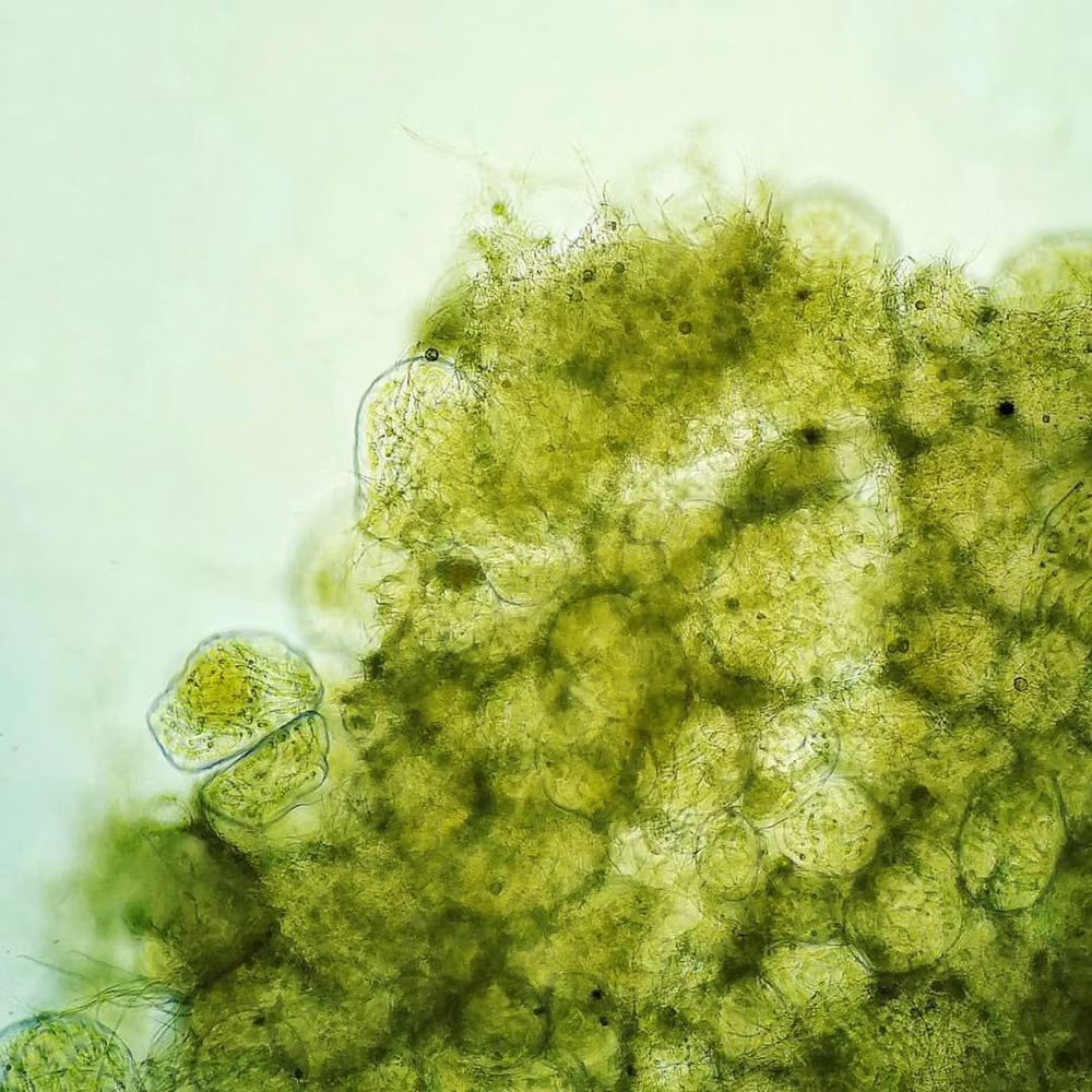 amoeba microscope photograph organic shape - What kind of algae is it❓ 🤔 . . #microscopy #microscope #biology #science #hobby #microbiology #pondlife #freshwater #waterdrop #life…